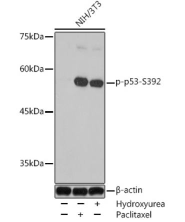 Phospho-p53-S392 Rabbit Polyclonal Antibody