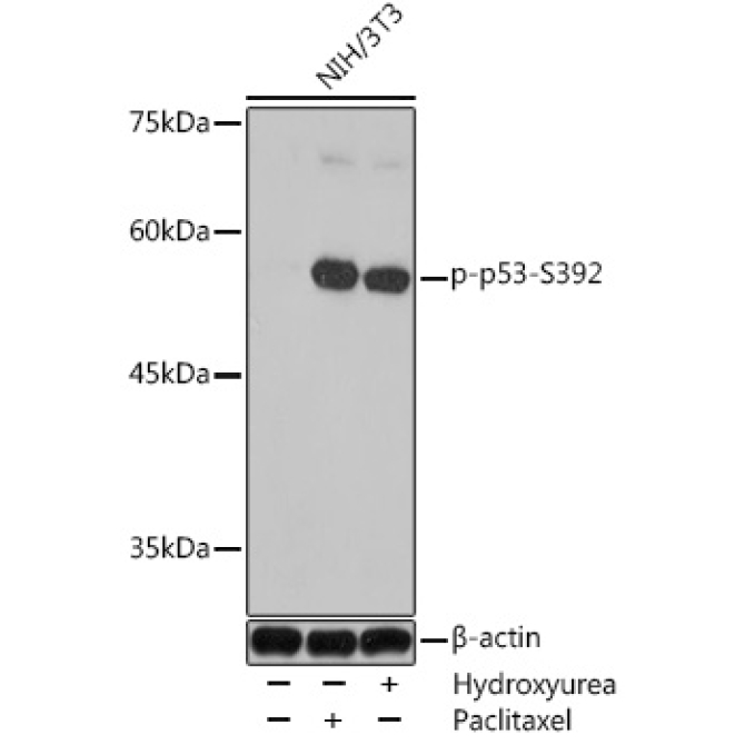 Phospho-p53-S392 Rabbit Polyclonal Antibody
