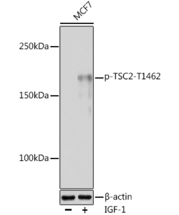 Phospho-TSC2-T1462 Rabbit Polyclonal Antibody