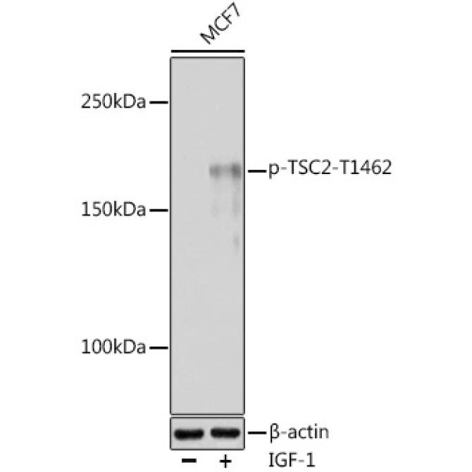 Phospho-TSC2-T1462 Rabbit Polyclonal Antibody