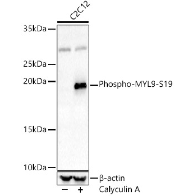 Phospho-MYL9-S19 Rabbit Polyclonal Antibody