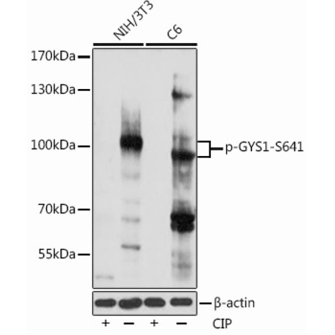Phospho-GYS1-S641 Rabbit Polyclonal Antibody