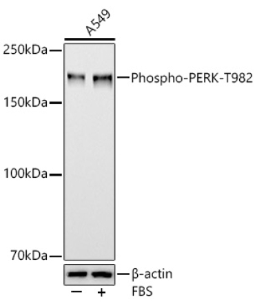 Phospho-PERK-T982 Rabbit Polyclonal Antibody