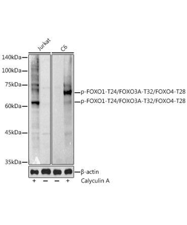 Phospho-FOXO1-T24/FOXO3A-T32/FOXO4-T28 Rabbit Polyclonal Antibody