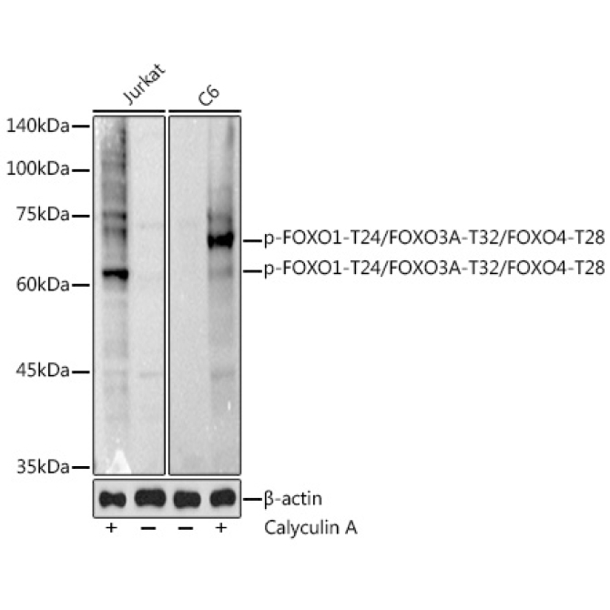Phospho-FOXO1-T24/FOXO3A-T32/FOXO4-T28 Rabbit Polyclonal Antibody