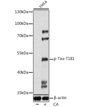 Phospho-Tau-T181 Rabbit Polyclonal Antibody