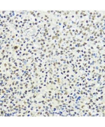 Phospho-Histone H3-T32 Rabbit Polyclonal Antibody