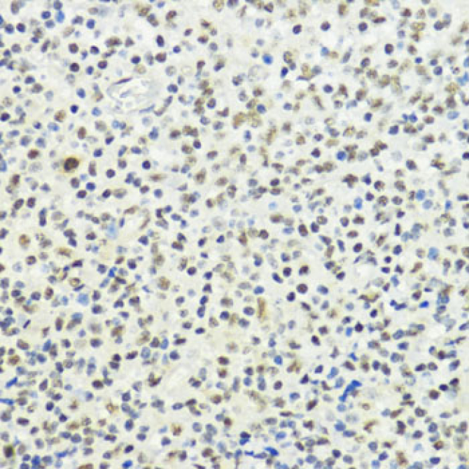 Phospho-Histone H3-T32 Rabbit Polyclonal Antibody