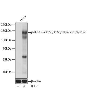 Phospho-IGF1R-Y1165/1166/INSR-Y1189/1190 Rabbit Polyclonal Antibody