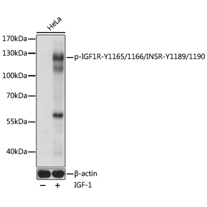 Phospho-IGF1R-Y1165/1166/INSR-Y1189/1190 Rabbit Polyclonal Antibody