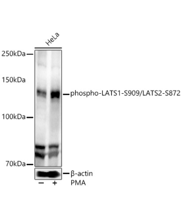 phospho-LATS1-S909/LATS2-S872 Rabbit Polyclonal Antibody