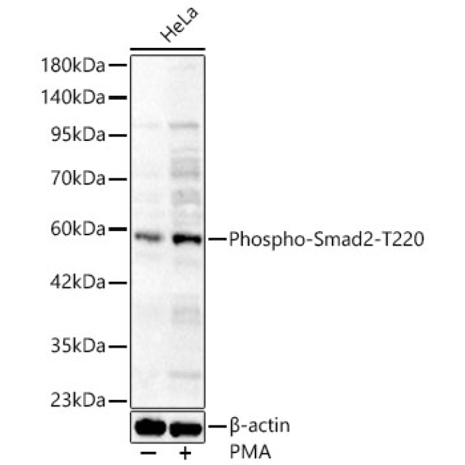 Phospho-Smad2-T220 Rabbit Polyclonal Antibody