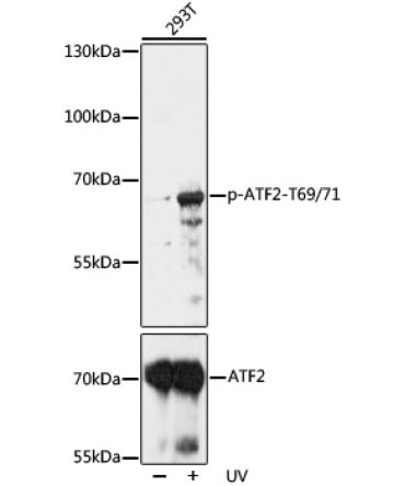 Phospho-ATF2-T69/71 Rabbit Polyclonal Antibody