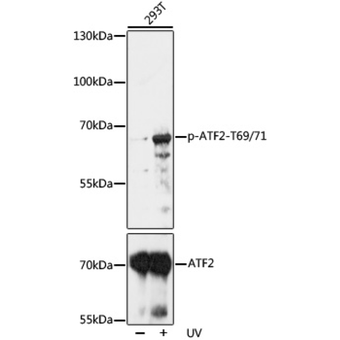 Phospho-ATF2-T69/71 Rabbit Polyclonal Antibody