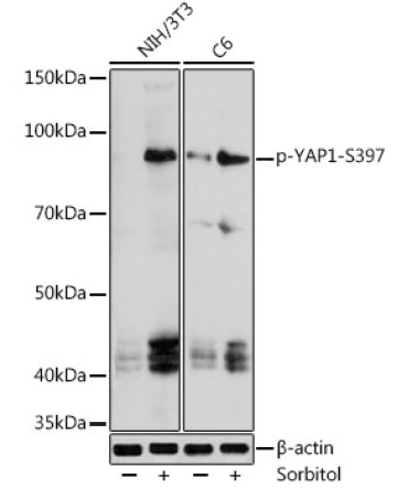 phospho-YAP1-S397 Rabbit Polyclonal Antibody