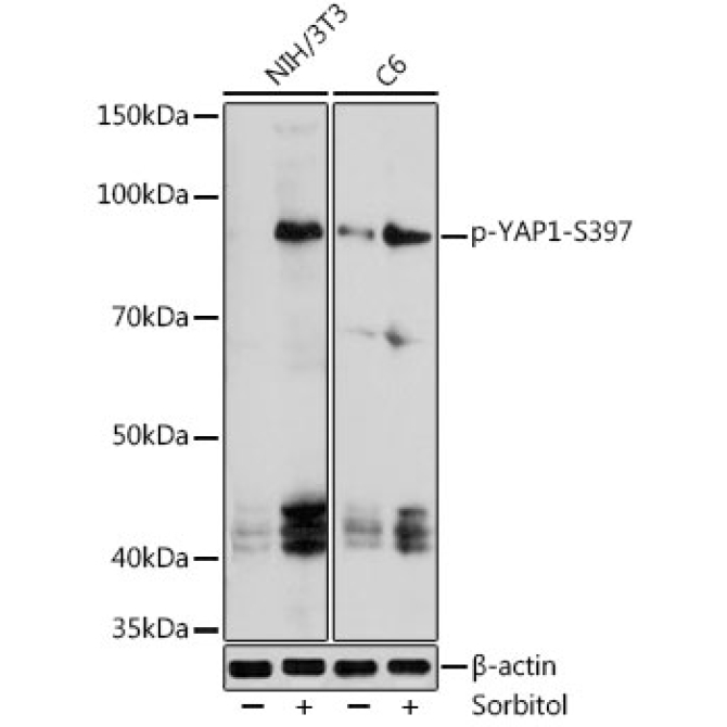 phospho-YAP1-S397 Rabbit Polyclonal Antibody