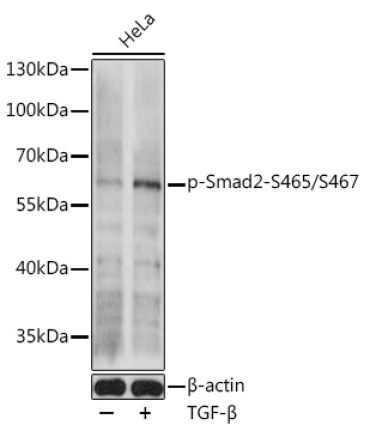 Phospho-Smad2-S465/S467 Rabbit Polyclonal Antibody