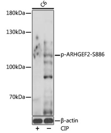Phospho-ARHGEF2-S886 Rabbit Polyclonal Antibody
