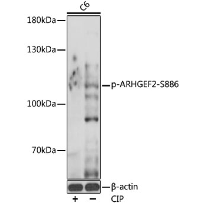 Phospho-ARHGEF2-S886 Rabbit Polyclonal Antibody