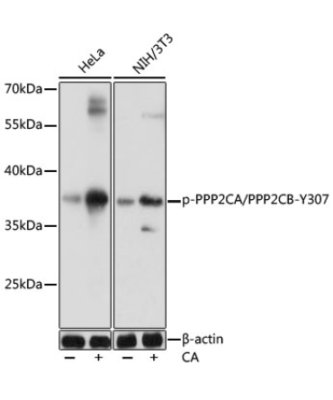 Phospho-PPP2CA/PPP2CB-Y307 Rabbit Polyclonal Antibody