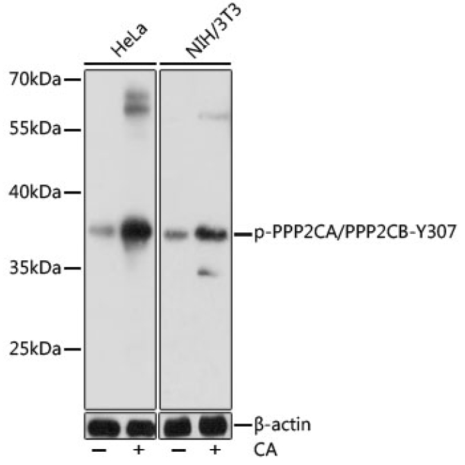 Phospho-PPP2CA/PPP2CB-Y307 Rabbit Polyclonal Antibody