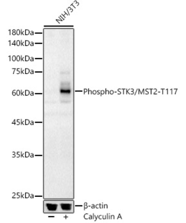 Phospho-STK3/MST2-T117 Rabbit Polyclonal Antibody