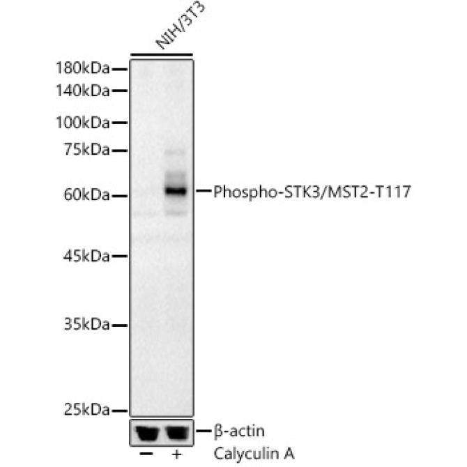 Phospho-STK3/MST2-T117 Rabbit Polyclonal Antibody