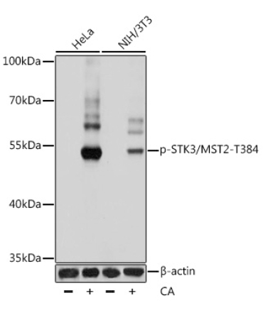 Phospho-STK3/MST2-T384 Rabbit Polyclonal Antibody