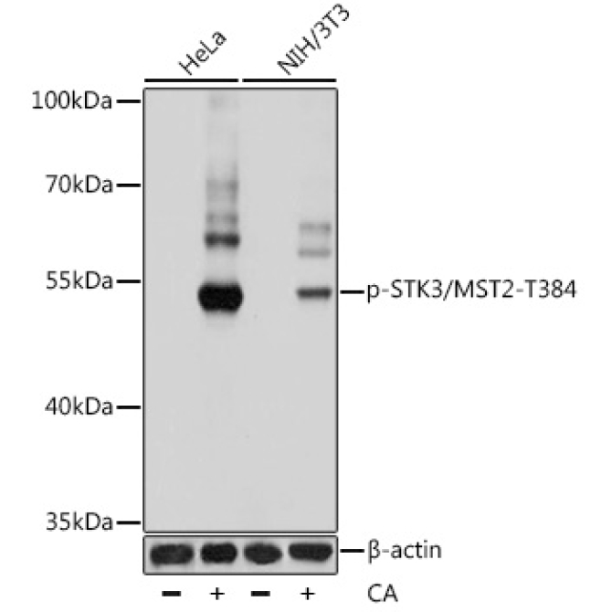 Phospho-STK3/MST2-T384 Rabbit Polyclonal Antibody