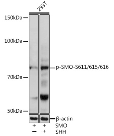 Phospho-SMO-S611/615/616 Rabbit Polyclonal Antibody