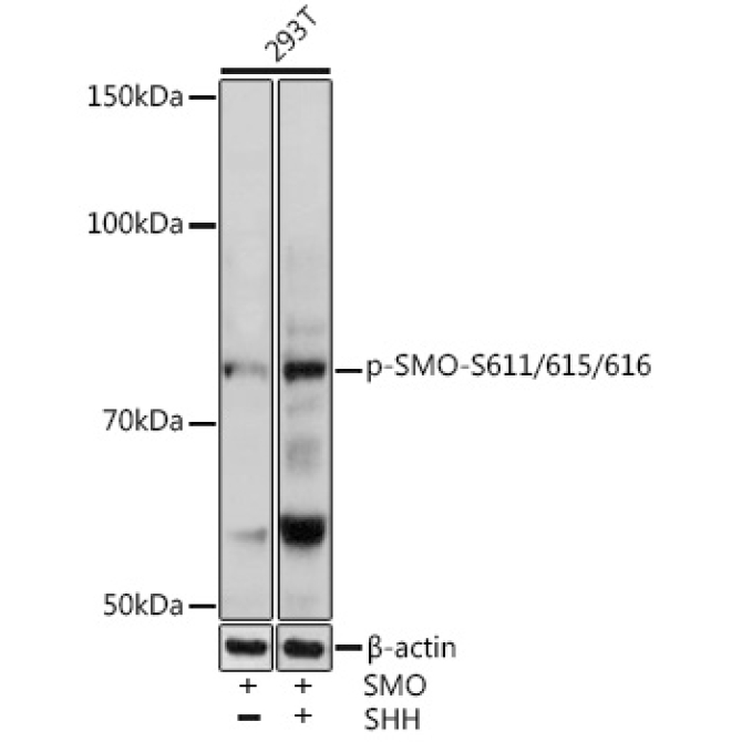 Phospho-SMO-S611/615/616 Rabbit Polyclonal Antibody