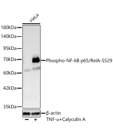 Phospho-NF-kB p65/RelA-S529 Rabbit Polyclonal Antibody
