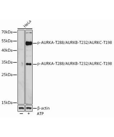 Phospho-AURKA-T288/AURKB-T232/AURKC-T198 Rabbit Polyclonal Antibody