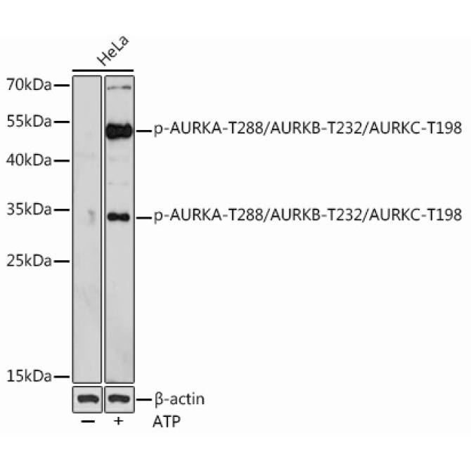 Phospho-AURKA-T288/AURKB-T232/AURKC-T198 Rabbit Polyclonal Antibody