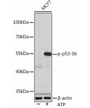 Phospho-p53-S6 Rabbit Polyclonal Antibody