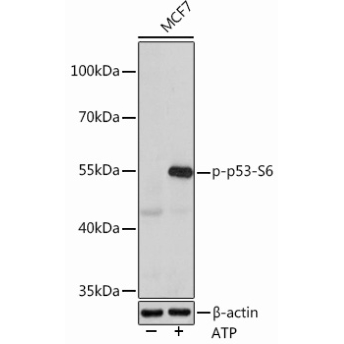Phospho-p53-S6 Rabbit Polyclonal Antibody