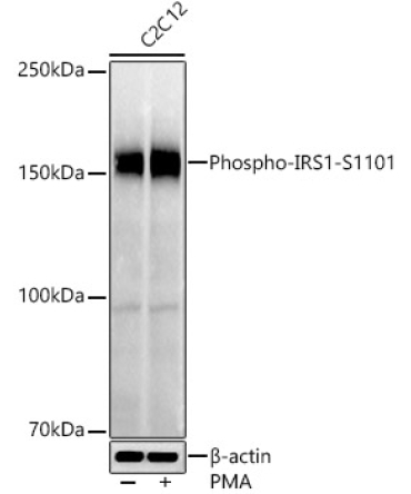Phospho-IRS1-S1101 Rabbit Polyclonal Antibody