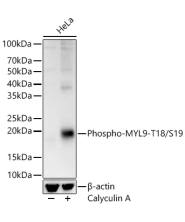 Phospho-MYL9-T18/S19 Rabbit Polyclonal Antibody