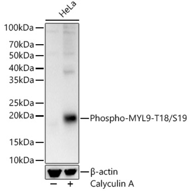 Phospho-MYL9-T18/S19 Rabbit Polyclonal Antibody