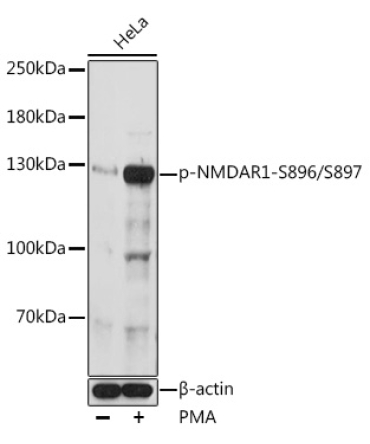 Phospho-NMDAR1-S896/S897 Rabbit Polyclonal Antibody
