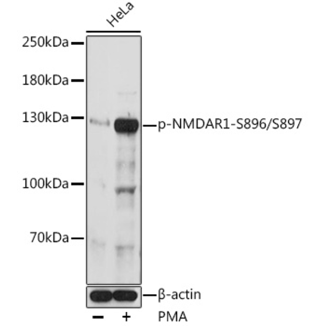 Phospho-NMDAR1-S896/S897 Rabbit Polyclonal Antibody