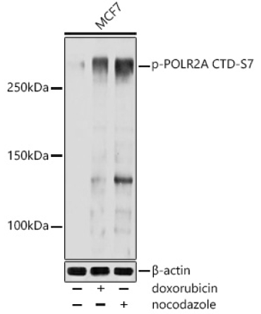 Phospho-POLR2A CTD-S7 Rabbit Polyclonal Antibody