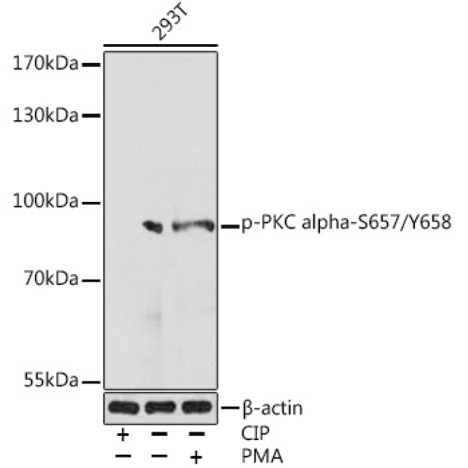 Phospho-PKC alpha-S657/Y658 Rabbit Polyclonal Antibody