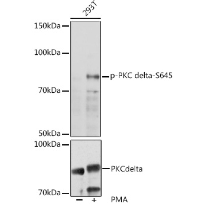 Phospho-PKC delta-S645 Rabbit Polyclonal Antibody