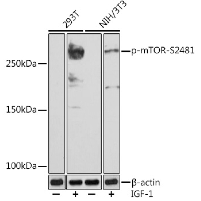Phospho-mTOR-S2481 Rabbit Monoclonal Antibody