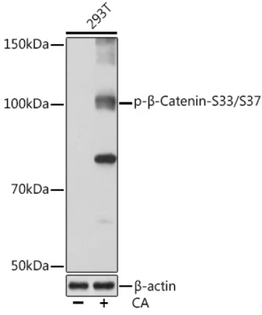 Phospho-Beta-Catenin-S33/S37 Rabbit Monoclonal Antibody