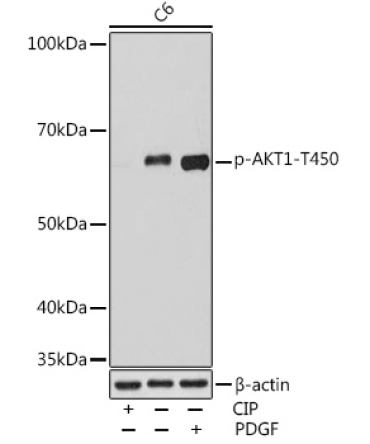 Phospho-AKT1-T450 Rabbit Monoclonal Antibody
