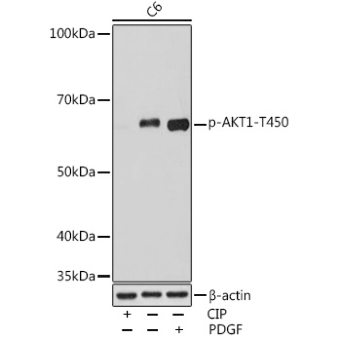 Phospho-AKT1-T450 Rabbit Monoclonal Antibody