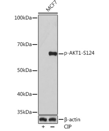 Phospho-AKT1-S124 Rabbit Monoclonal Antibody