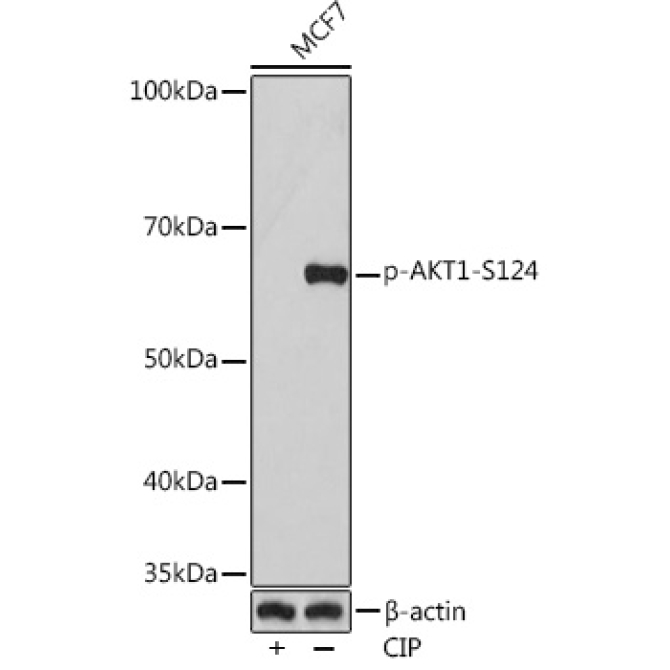 Phospho-AKT1-S124 Rabbit Monoclonal Antibody